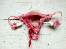 Uterus